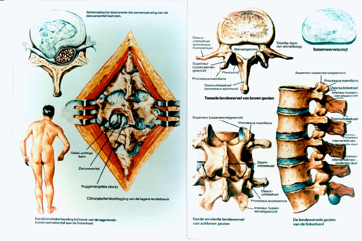 Ondersteuning van de rug tijdens het slapen